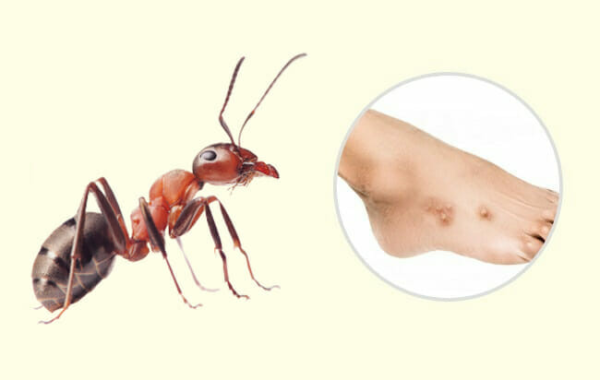 Cliquer pour de plus de détails sur les fourmis et cafards